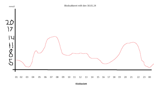 My bloodsugar levels 30.01.24